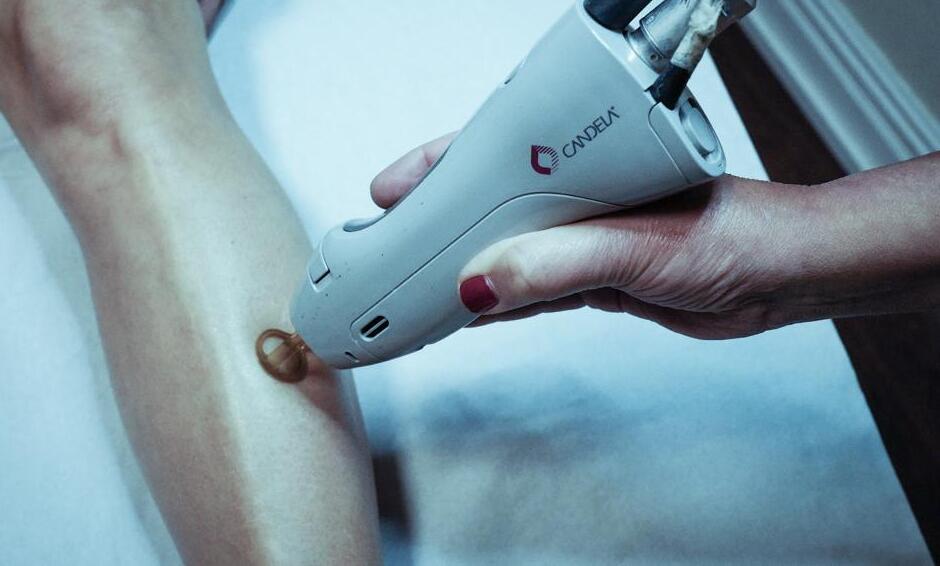 Técnico aplicando un tratamiento de depilación láser en la pierna de un cliente